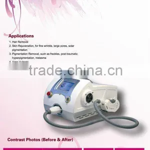 Professional Ipl Face &body Hair Remover Machine on Promotion thumbnail-5