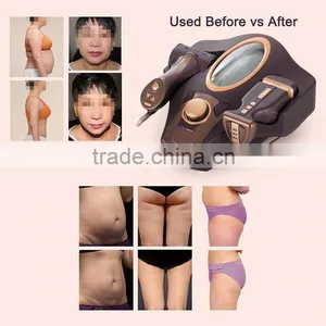 Manufacturer Wholesale Face Lift Machine Weight Loss and Pressure Therapy Equipment thumbnail-5