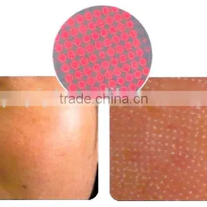 Spot Scar Pigment Removal Fractional Co2 Fractional Laser Vaginal Tightening Medical Treat Telangiectasis & Acne Scar Removal Machine CO2 Laser Skin Renewing thumbnail-2