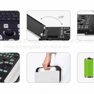 Notebook Ultrasound Scanner Detector for Human Pregnancy Checking thumbnail-2