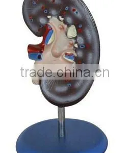 Kidney Model,organ Model thumbnail-1
