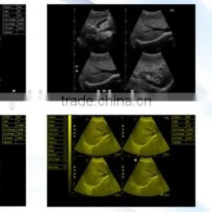 2016 New 3D Laptop Ultrasound Scanner (PC System) on Sale thumbnail-6