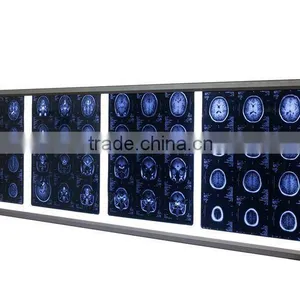 Uniform Illumination Negatoscope Film Viewer thumbnail-1
