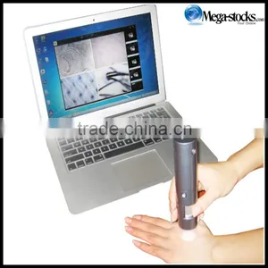 2MP 600X HD Scalp Detector, Hair Detector, Skin Detector, Wireless WiFi Connection Phone Tablet Hair Analyzer thumbnail-6