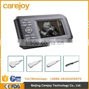 5.5 Inch Portable Ultrasound Scanner With Rechargeable Battery thumbnail-1