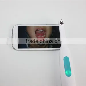 Home Using Detal Came With Wifi 720p Full hd Intra Oral hd Camera thumbnail-6