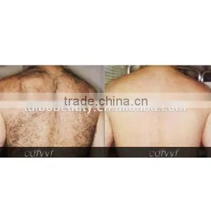 New 2016 Mini Ipl Laser Hair Removal Machine Skin Rejuvenation Beauty Equipment Supplier thumbnail-6