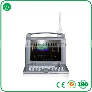 Laptop Color Doppler 2D Ultrasound Machine 12.1" High-resolution LCD thumbnail-1