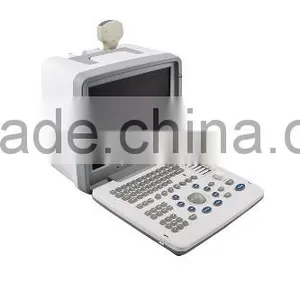 12-inch LCD Monitor 2 Probe Connector 1 USB Full Digital LED Portable Ultrasound Scanner for Sale thumbnail-5