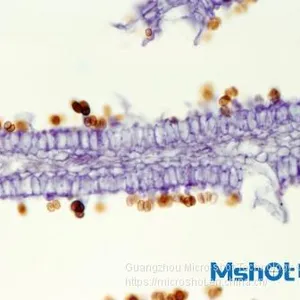 Routine Biological Microscope With Trinocular Observation Tube ML31 thumbnail-2
