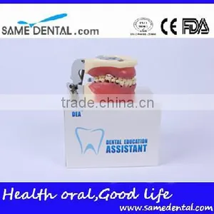Dental Severe Periodontal Disease Model School Teaching thumbnail-6