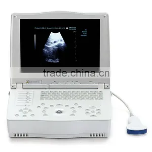 2016 New 15-inch Laptop Ultrasound Scanner With Low Price thumbnail-6