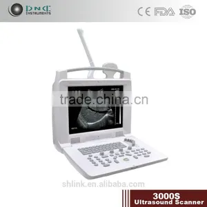 Medical Portable Ultrasonic Diagnostic System/Ultrasound Scanner 3000S thumbnail-1