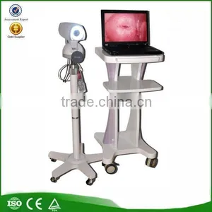 Medical Equipment Portable Digital Camera Vaginoscope Colposcope thumbnail-1