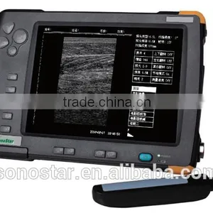 V5 Palm Ultrasound Scanner(ultrasonic,black White,Imaging Sys thumbnail-2
