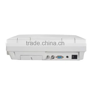 CE & ISO Full Digital Portable Ultrasound Machine Cheap Price PC Ultrasound Scanner for Human thumbnail-5