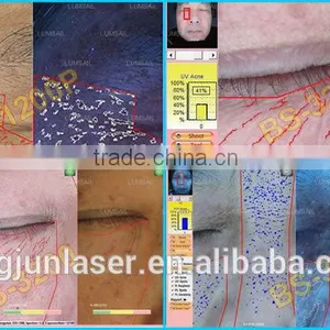 2016 Latest Amazing Magic Skin Analyzer, Skin Scope Analyzer thumbnail-4