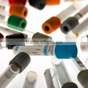 Model HY-150B Vacutainer Blood Test Tube Labeling Machine Manufacturer thumbnail-2