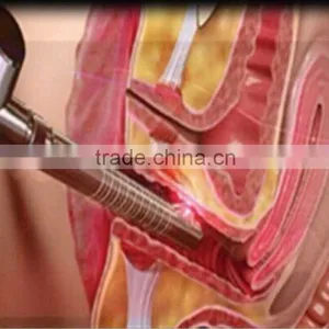 Fractional CO2 Laser Scar Removal Vaginal Tightening Facial Acne Pit Removal thumbnail-4