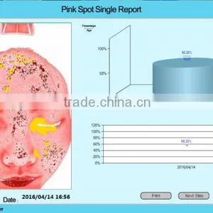 3D Scanners Magic Mirror Facical Skin Scope Spectrum Analyzer Facial Skin Analyzer thumbnail-5