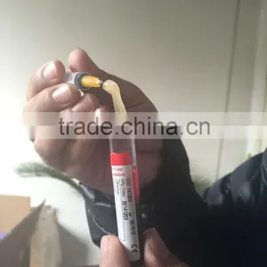 Vacuum Sterile and Pyrogen Free Platelet Rich Fibrin PRF Tube thumbnail-2