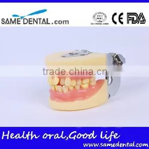 Dental Extraction Model School Teaching Model Teeth Model thumbnail-2