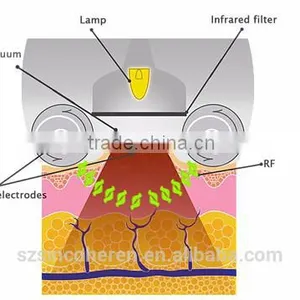 Best Vacuum Rooler Massage Body Shape Vela Slim Equipment thumbnail-6