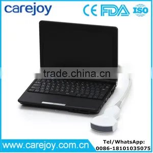 Carejoy Laptop Ultrasound Scanner / Machine With 3.5Mhz Convex Probe by CE ISO Approved thumbnail-1
