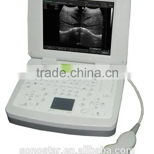 SS-9 PC Based Laptop Ultrasound B Scanner thumbnail-1