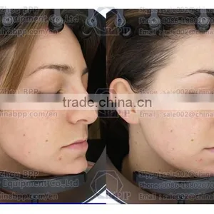 RGB and UV Spectrum Skin Analysis Camera for Analysis Skin Characteristic thumbnail-5