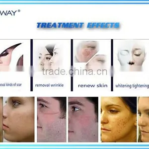 Hottest !!!!!! High Power 40W Wrinkles Removal Skin Treatment Co2 Fractional Laser for Sale thumbnail-4