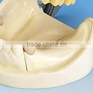 Typodont Orthodontic Model for Practicing Teeth Model Factory thumbnail-5