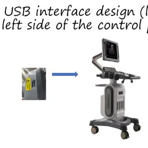 China Trolley 4D Color Doppler Ultrasound (YJ-U10T) thumbnail-2