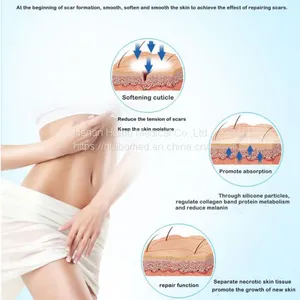 Silicone Gel Scar Patch，scar Repair Patch, Scar Removal Sheet, Silicone Scar Sheet, Medical Silicone Film Dressing, Scar Repair Patch，medical Scar Sheet thumbnail-5