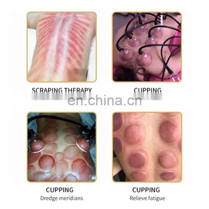 HOT Factory Vacuum Therapy Breast Enlargement Machine Vacuum Pump Butt Lift Breast Sucking Body Therapy Lymph Drainage thumbnail-5