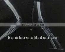 Digital Camera,x-ray Laser Medical Films,patient Camera thumbnail-1