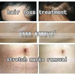 Microneedle Derma Roller Mts System 540 Microneedle Titanium thumbnail-6