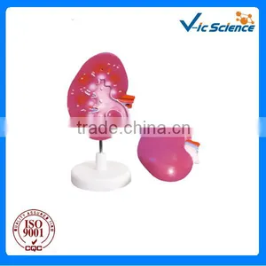 Kidney Enlarge Anatomy Model thumbnail-1
