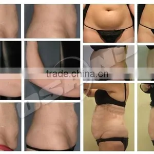 220 / 110V Freezing Pads Cryolipolysis Crypolysis Fat Freezing Machine Vertical thumbnail-4