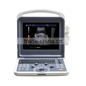 Digital Color Doppler 4D Ultrasound Machine K6 thumbnail-2