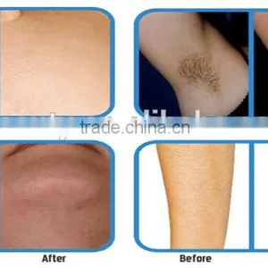 1-50J/cm2 Best Shr IPL/OPT/AFT Hair Chest Hair Removal Removal Device With Best Price Remove Diseased Telangiectasis thumbnail-6