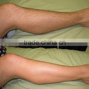 Multifunctional Low Price 808 Diode Laser Alma Laser Female Soprano Ice Laser Hair Removal Machine Ipl Shr thumbnail-5