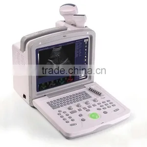 Ultrasound Scanner (WG-160) thumbnail-1