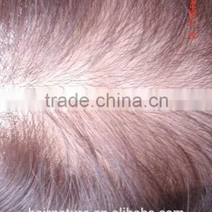 Injected Lace Hair Pieces thumbnail-3