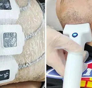Vertical 10 in 1 Monopolar RF Face Skin Tightening Machine Fat Dissolving Trusculpt ID Flex Body Sculpting Machine thumbnail-5