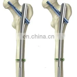 Orthopedic Trauma Implants PFNA thumbnail-3