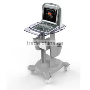 China Cheap Price USB Portable Laptop Color Doppler Ultrasound Scanner for Pregnancy Scanner Ultrasound thumbnail-2