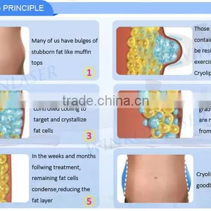 Price Cryolipolysis / Cryolipolysie Weight Loss / Cryolipolysis Body Slimming Machine Fat Melting thumbnail-6