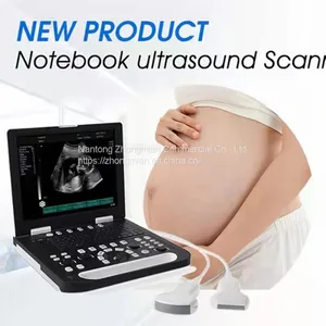 Notebook Ultrasound Scanner Detector for Human Pregnancy Checking thumbnail-1