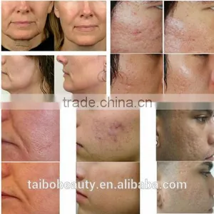 Fractional rf Micro Needling Wrinkle Removal Machine From Beauty Salon Equipment Supplier thumbnail-6